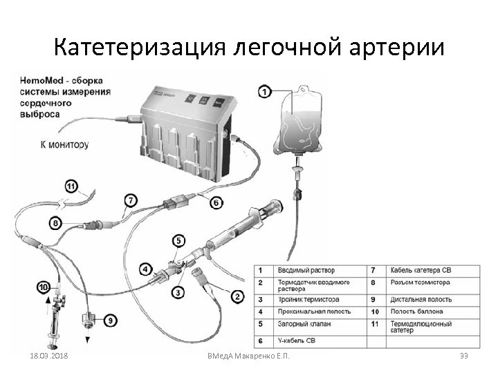 Катетеризация легочной артерии 18. 03. 2018 ВМед. А Макаренко Е. П. 33 