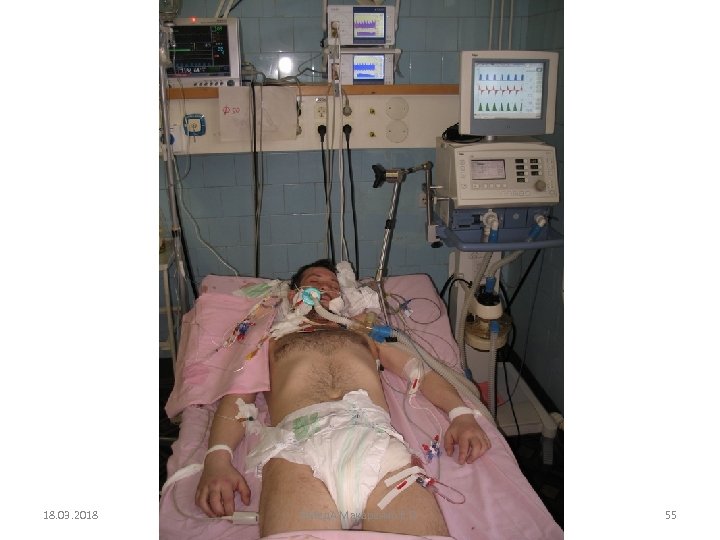 18. 03. 2018 ВМед. А Макаренко Е. П. 55 