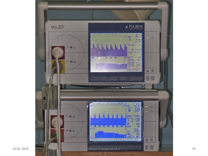 18. 03. 2018 ВМед. А Макаренко Е. П. 56 