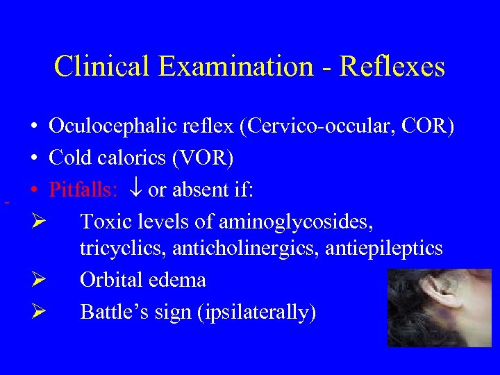Clinical Examination - Reflexes • Oculocephalic reflex (Cervico-occular, COR) • Cold calorics (VOR) •