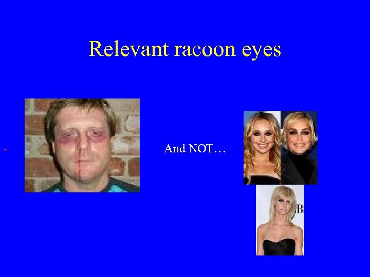 Relevant racoon eyes And NOT… 