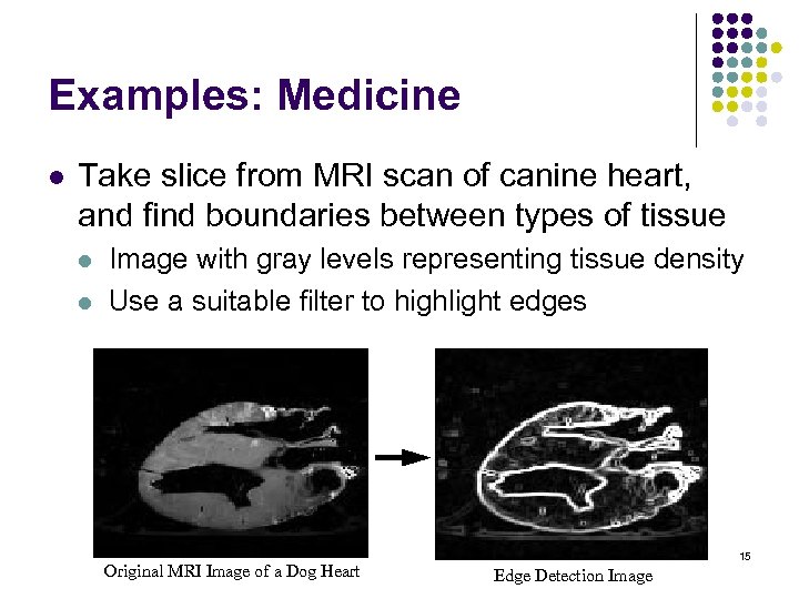 Examples: Medicine l Take slice from MRI scan of canine heart, and find boundaries