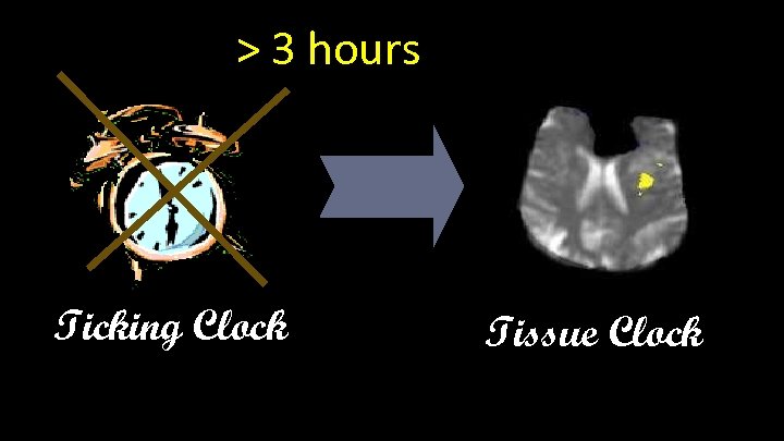 > 3 hours Ticking Clock Tissue Clock 