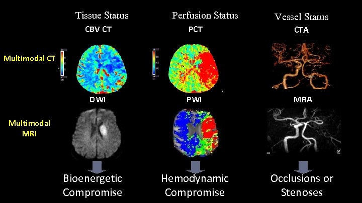Tissue Status Perfusion Status Vessel Status CBV CT PCT CTA DWI PWI MRA Hemodynamic
