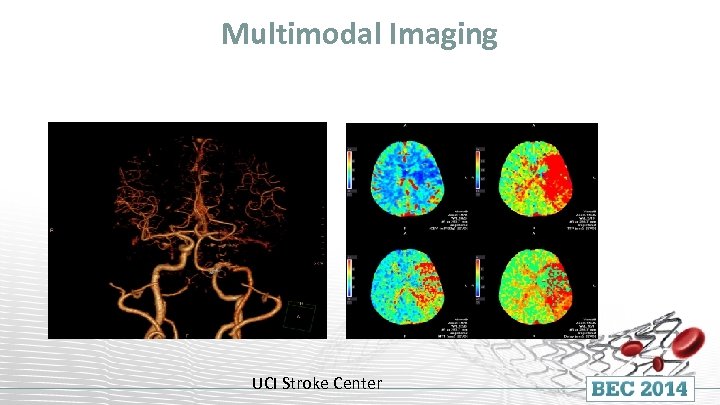 Multimodal Imaging UCI Stroke Center 