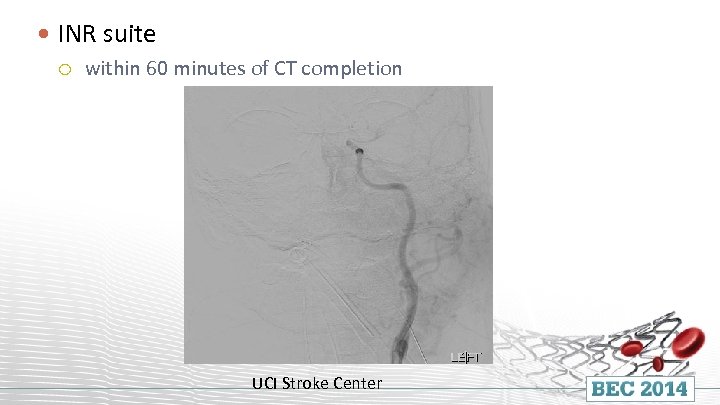  INR suite within 60 minutes of CT completion UCI Stroke Center 