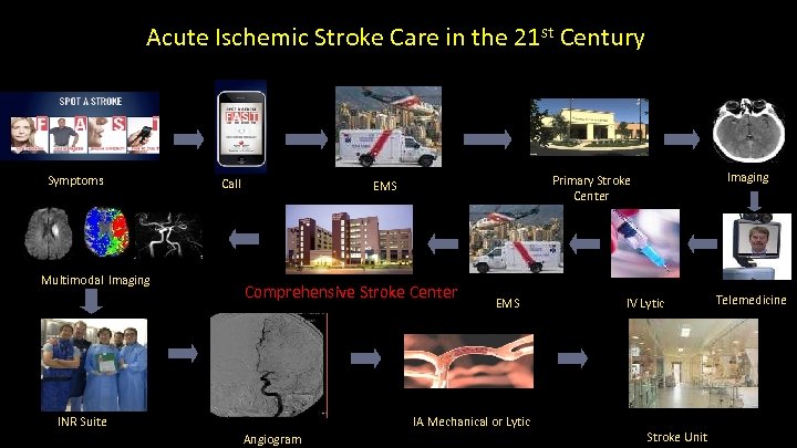 Acute Ischemic Stroke Care in the 21 st Century UCI Stroke Center Symptoms Multimodal
