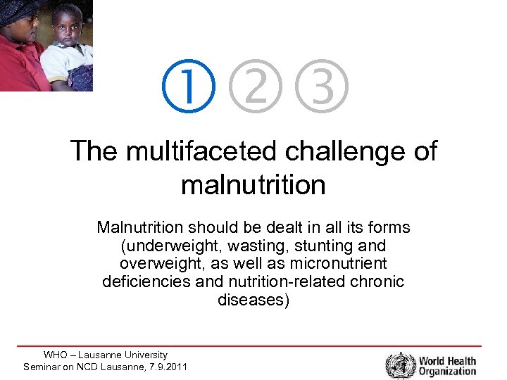  The multifaceted challenge of malnutrition Malnutrition should be dealt in all its forms