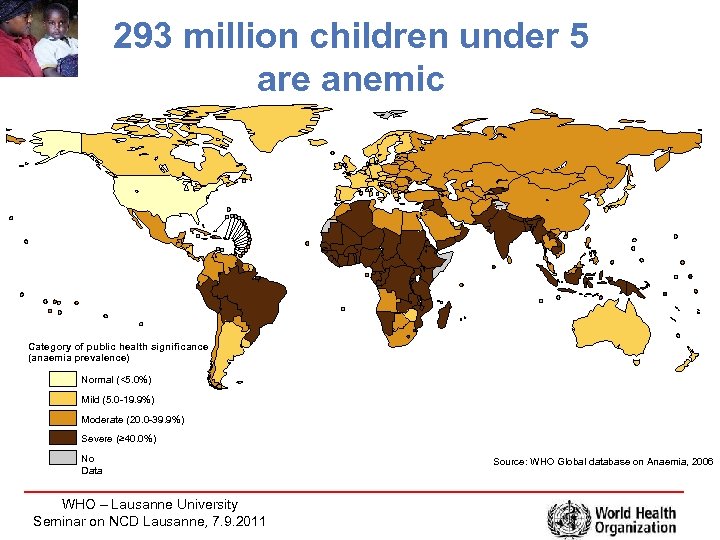 293 million children under 5 are anemic Category of public health significance (anaemia prevalence)