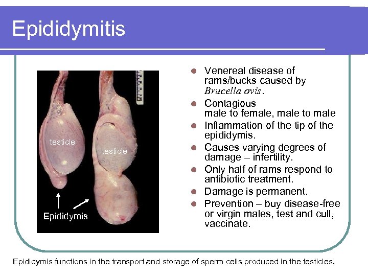 Epididymitis l l l testicle l l Epididymis Venereal disease of rams/bucks caused by