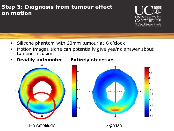 Step 3: Diagnosis from tumour effect on motion § § § Silicone phantom with