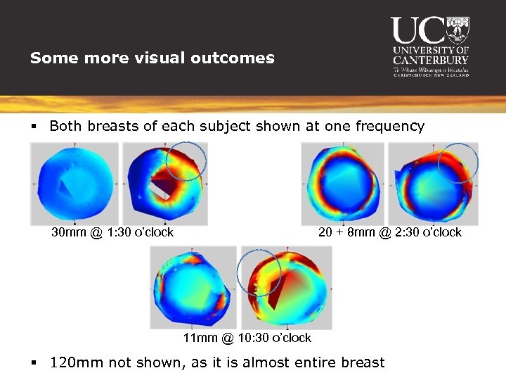 Some more visual outcomes § Both breasts of each subject shown at one frequency