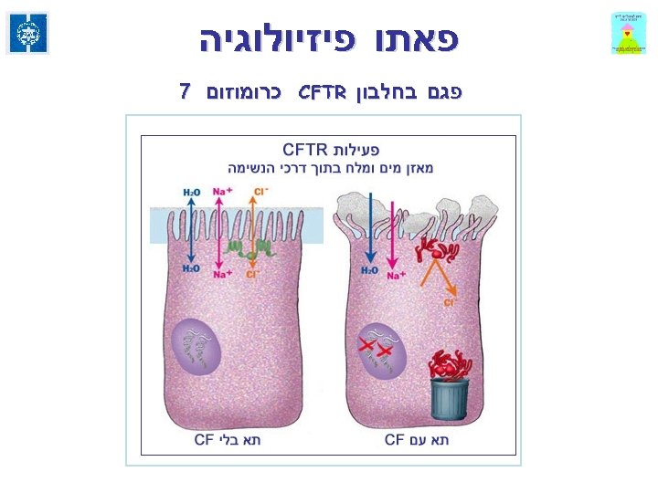  פאתו פיזיולוגיה פגם בחלבון CFTR כרומוזום 7 