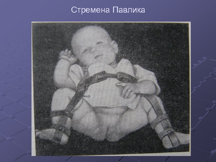 Стремена Павлика 