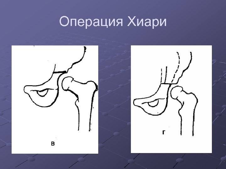 Операция Хиари 