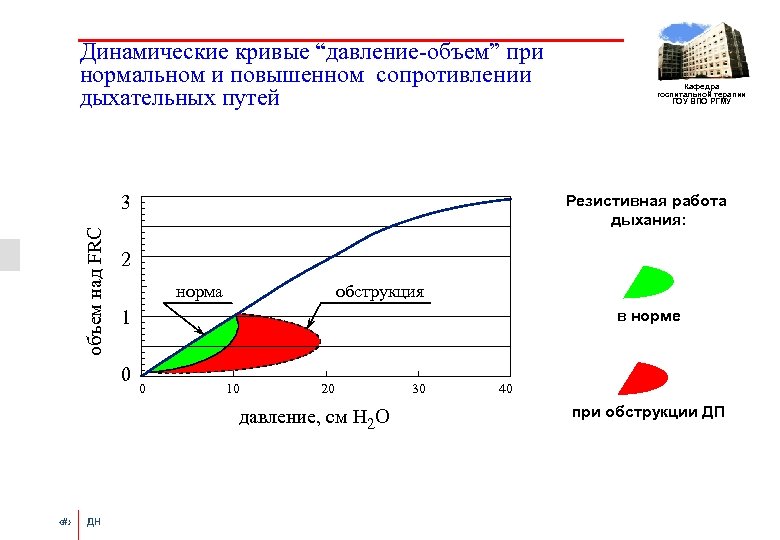 Динамические кривые “давление-объем” при нормальном и повышенном сопротивлении дыхательных путей объем над FRC 3