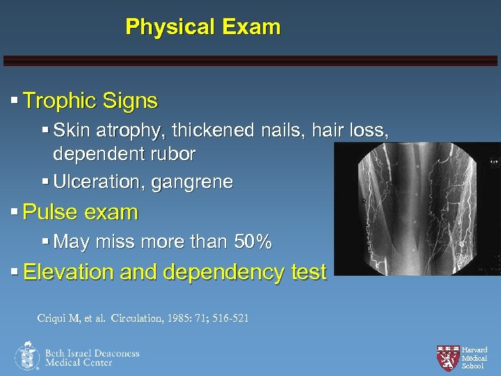 Physical Exam § Trophic Signs § Skin atrophy, thickened nails, hair loss, dependent rubor
