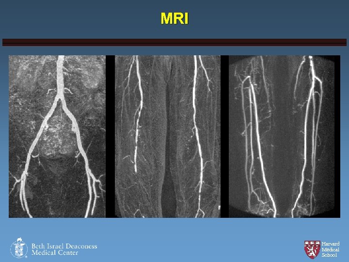 MRI Harvard Medical School 