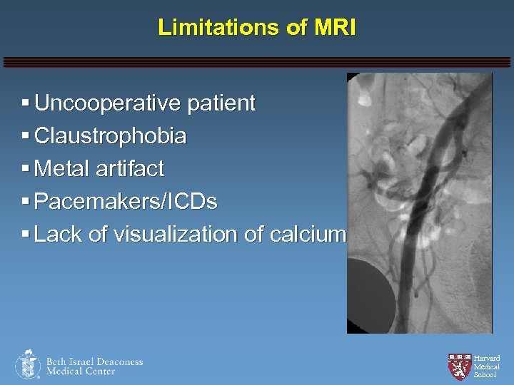Limitations of MRI § Uncooperative patient § Claustrophobia § Metal artifact § Pacemakers/ICDs §
