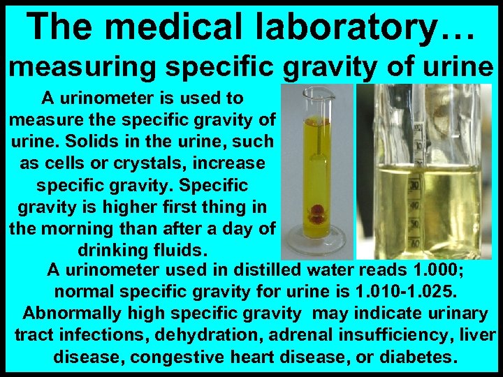 The medical laboratory… measuring specific gravity of urine A urinometer is used to measure