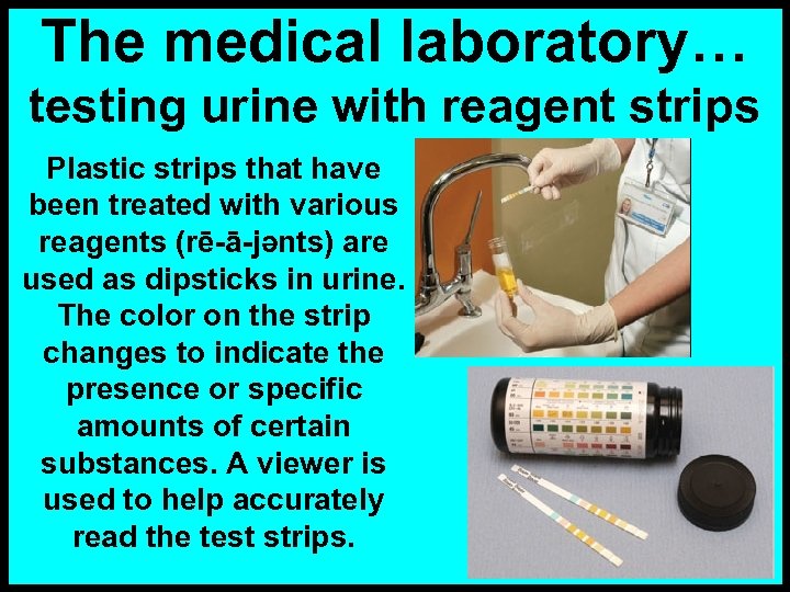 The medical laboratory… testing urine with reagent strips Plastic strips that have been treated