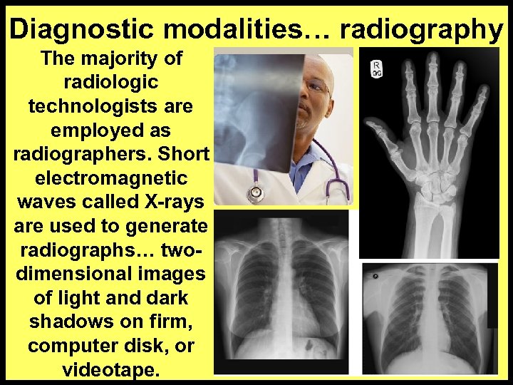Diagnostic modalities… radiography The majority of radiologic technologists are employed as radiographers. Short electromagnetic