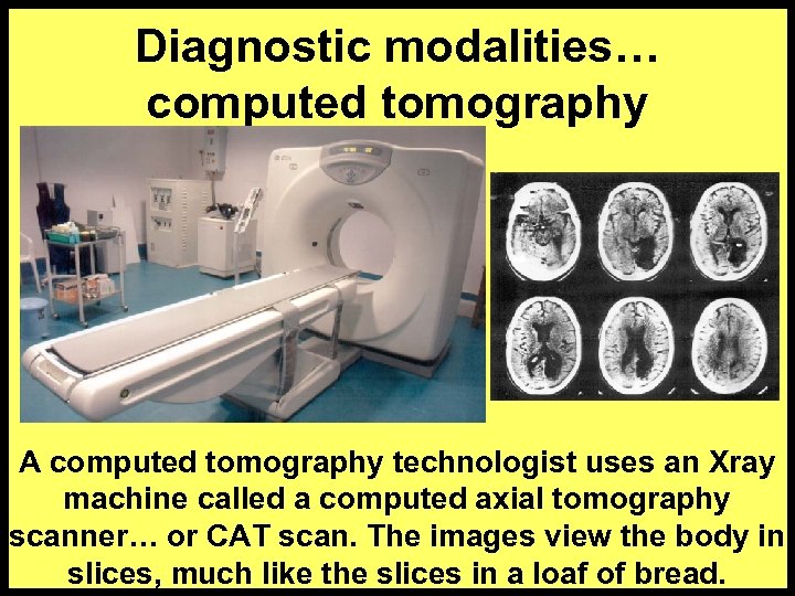 Diagnostic modalities… computed tomography A computed tomography technologist uses an Xray machine called a