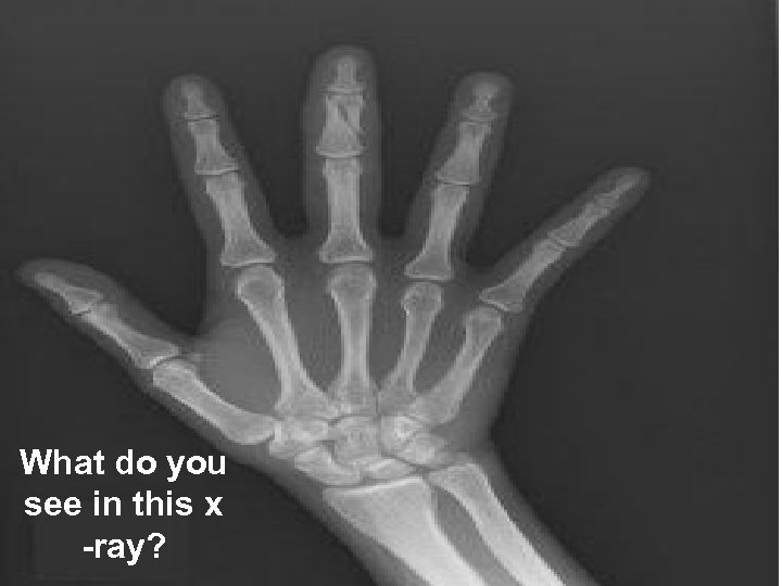 What do you see in this x -ray? 