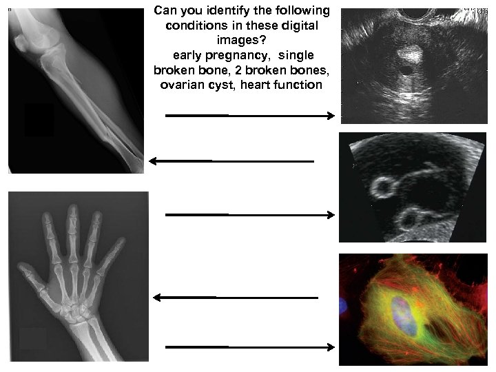 Can you identify the following conditions in these digital images? early pregnancy, single broken