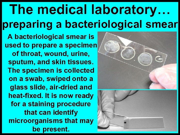 The medical laboratory… preparing a bacteriological smear A bacteriological smear is used to prepare