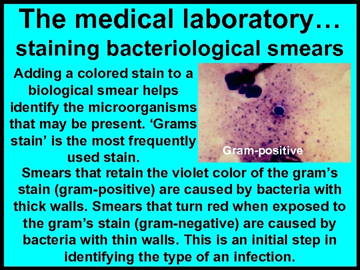 The medical laboratory… staining bacteriological smears Adding a colored stain to a biological smear