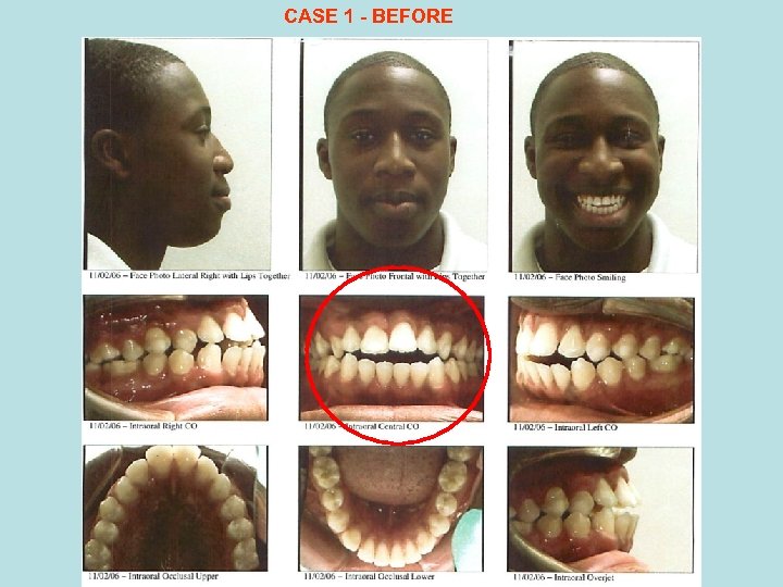 CASE 1 - BEFORE 