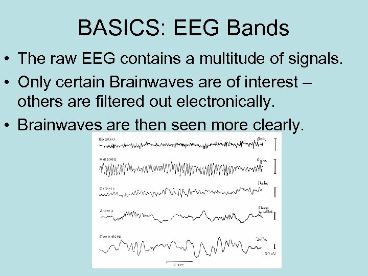 BASICS: EEG Bands • The raw EEG contains a multitude of signals. • Only