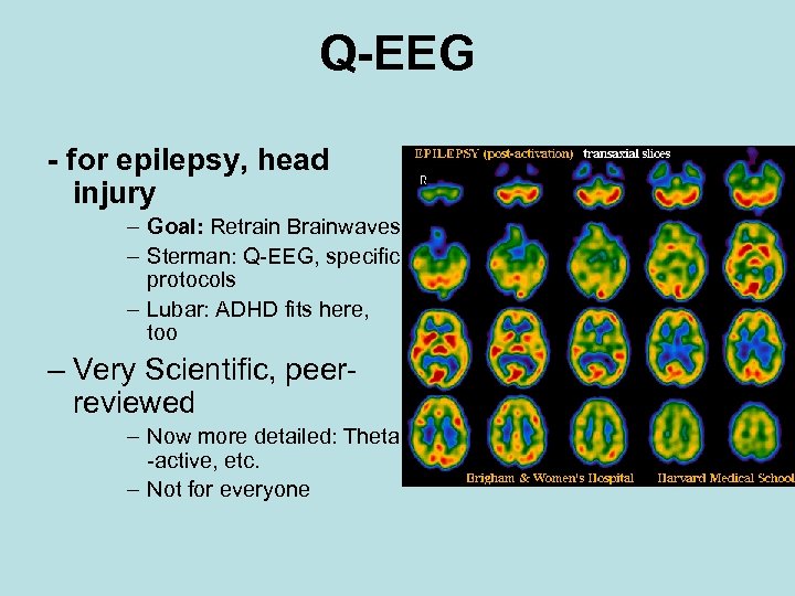 Q-EEG - for epilepsy, head injury – Goal: Retrain Brainwaves – Sterman: Q-EEG, specific