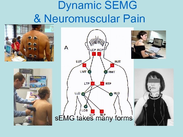 Dynamic SEMG & Neuromuscular Pain s. EMG takes many forms 