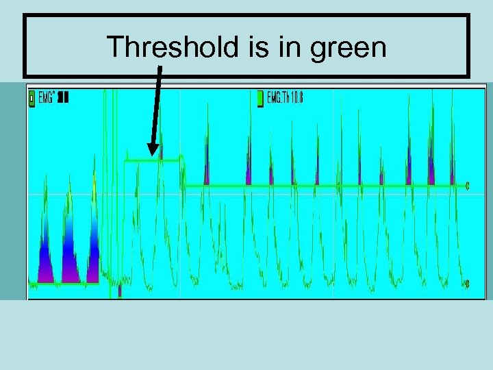 Threshold is in green 
