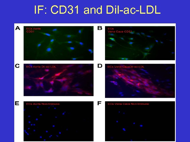 IF: CD 31 and Dil-ac-LDL 