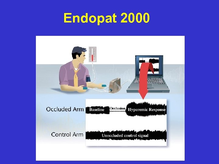 Endopat 2000 