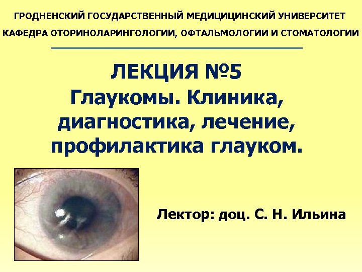 ГРОДНЕНСКИЙ ГОСУДАРСТВЕННЫЙ МЕДИЦИЦИНСКИЙ УНИВЕРСИТЕТ КАФЕДРА ОТОРИНОЛАРИНГОЛОГИИ, ОФТАЛЬМОЛОГИИ И СТОМАТОЛОГИИ ЛЕКЦИЯ № 5 Глаукомы. Клиника,