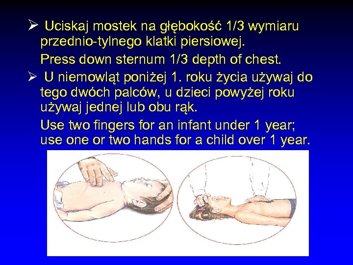 Ø Uciskaj mostek na głębokość 1/3 wymiaru przednio-tylnego klatki piersiowej. Press down sternum 1/3