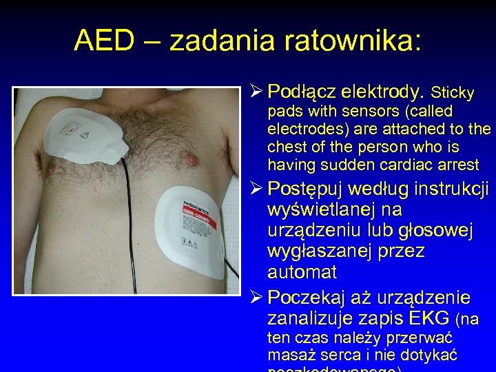 AED – zadania ratownika: Ø Podłącz elektrody. Sticky pads with sensors (called electrodes) are