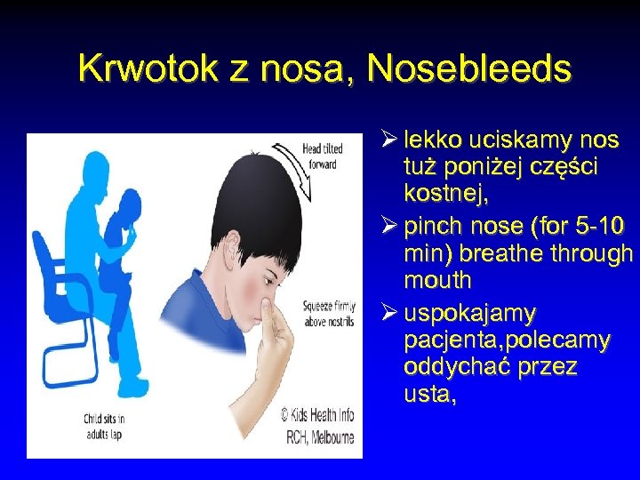 Krwotok z nosa, Nosebleeds Ø lekko uciskamy nos tuż poniżej części kostnej, Ø pinch