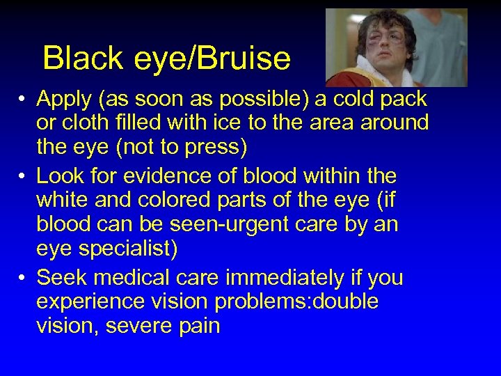 Black eye/Bruise • Apply (as soon as possible) a cold pack or cloth filled