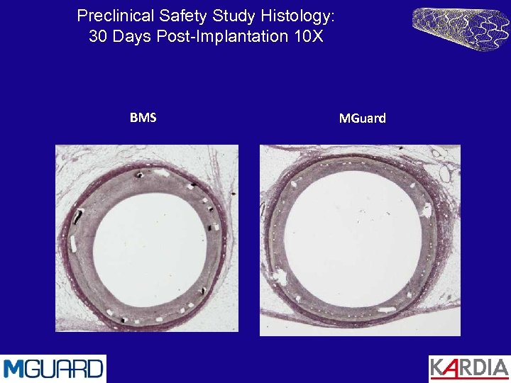 Preclinical Safety Study Histology: 30 Days Post-Implantation 10 X BMS MGuard 