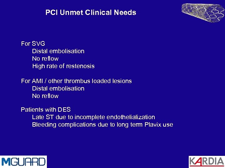 PCI Unmet Clinical Needs For SVG Distal embolisation No reflow High rate of restenosis