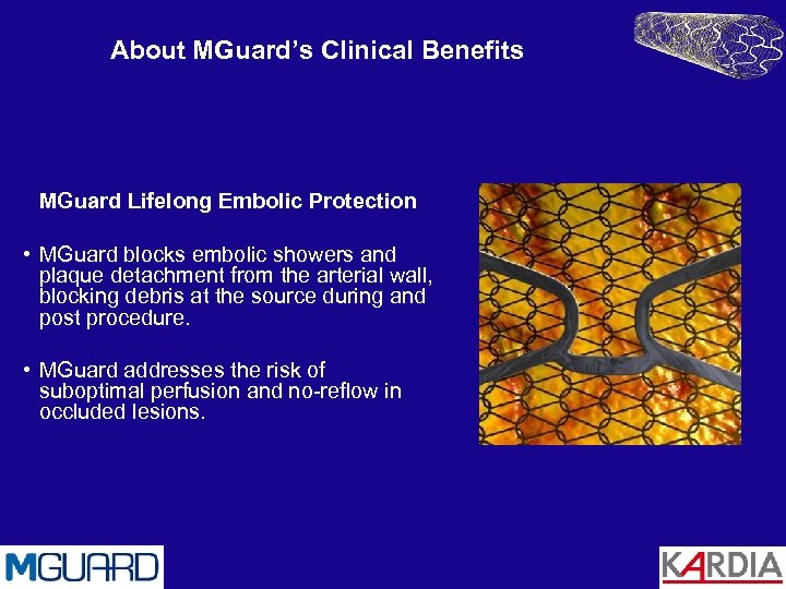 About MGuard’s Clinical Benefits MGuard Lifelong Embolic Protection • MGuard blocks embolic showers and