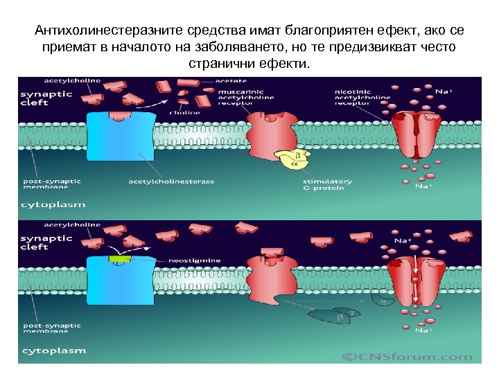 Антихолинестеразните средства имат благоприятен ефект, ако се приемат в началото на заболяването, но те