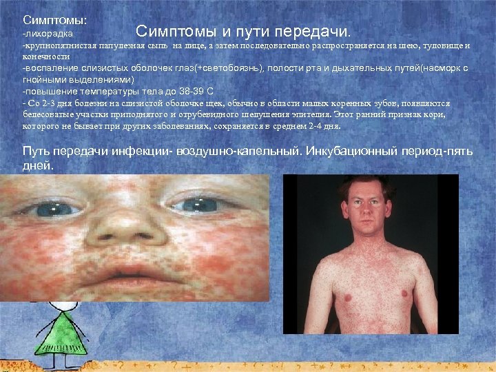 Симптомы: Симптомы и пути передачи. -лихорадка -крупнопятнистая папулезная сыпь на лице, а затем последовательно