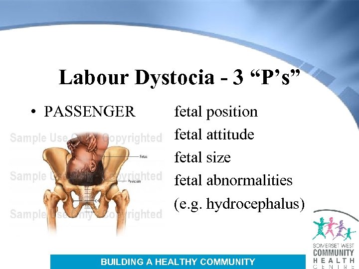 Labour Dystocia - 3 “P’s” • PASSENGER fetal position fetal attitude fetal size fetal