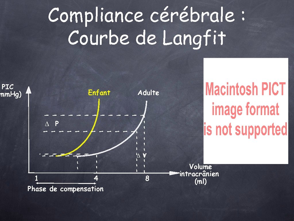 Compliance cérébrale : Courbe de Langfit PIC mm. Hg) Enfant Adulte Δ P ΔV